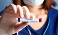Майже 700 мешканців Рівного очікують тестування на коронавірус