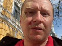 У Києві побили Майкла Щура, який зробив зауваження водієві самоката
