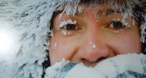 обмороження