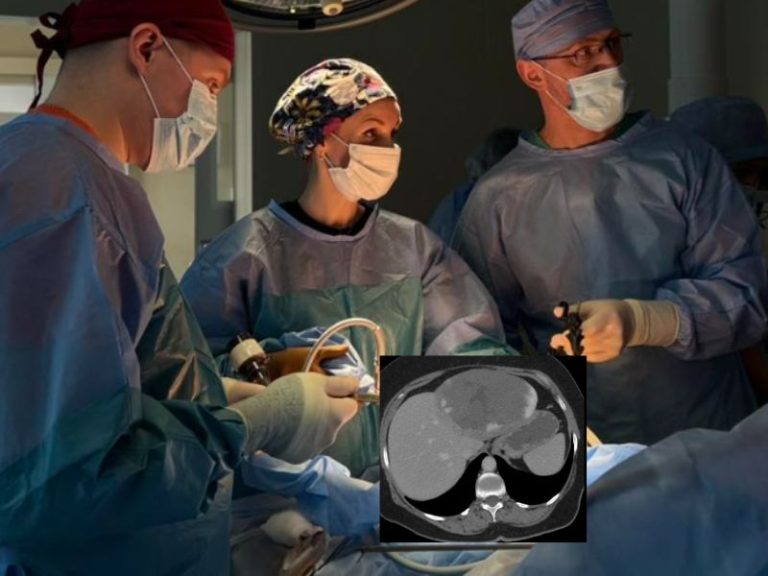 пухлину печінки