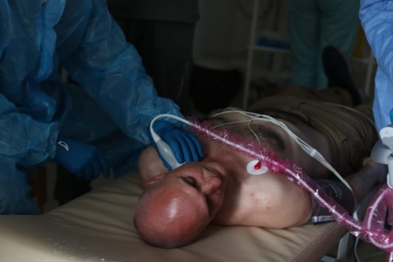 У рівненському госпіталі впроваджують сучасні методи лікування ПТСР